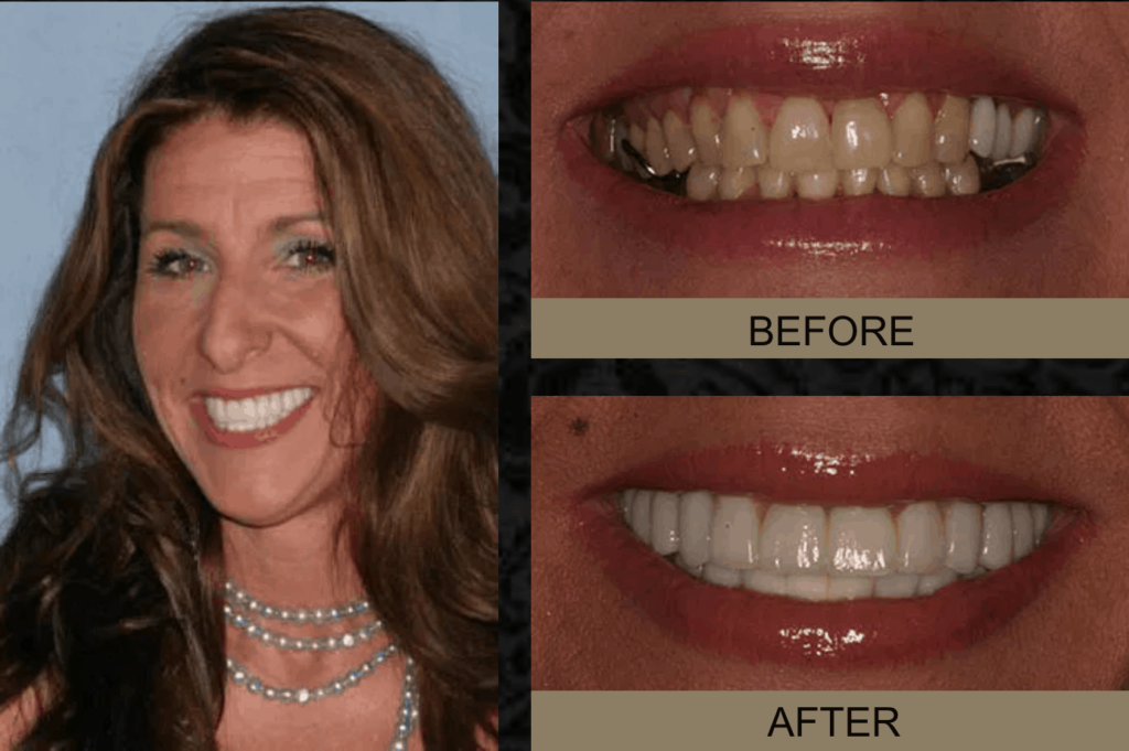 dental before & after