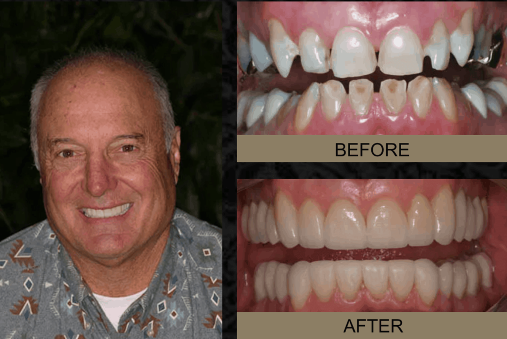 dental before & after