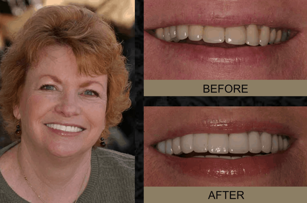 dental before & after