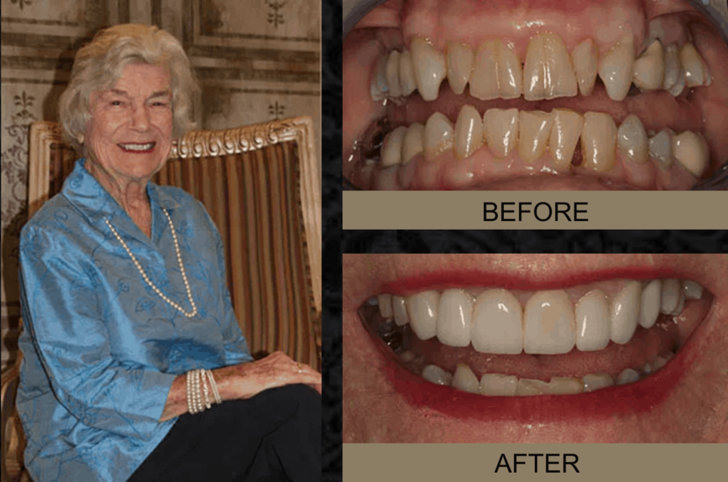 dental before & after