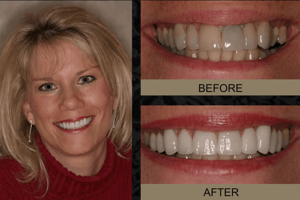 dental before & after