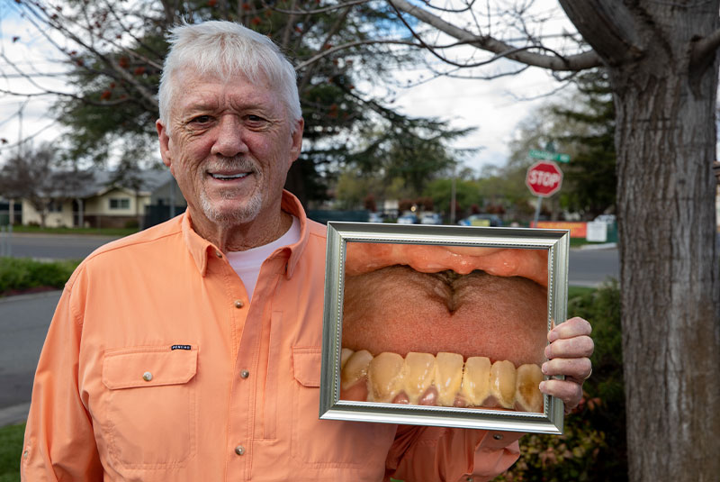 dental patient holding photo of before procedure