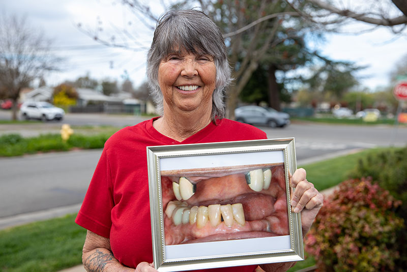 dental patient holding up photo of before procedure