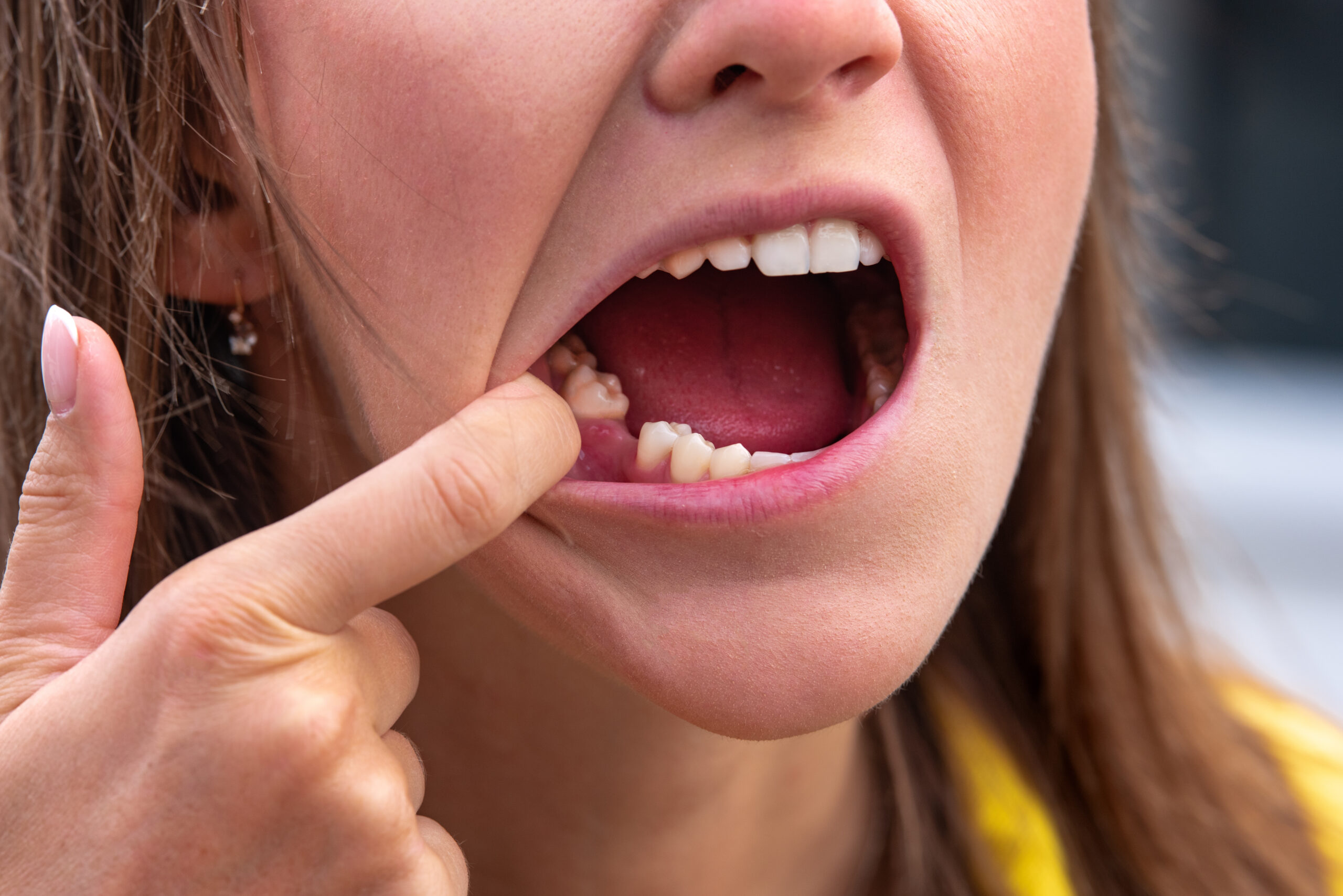 explore your options for replacement health