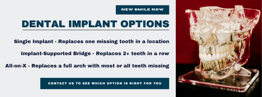dental implants for multiple missing teeth