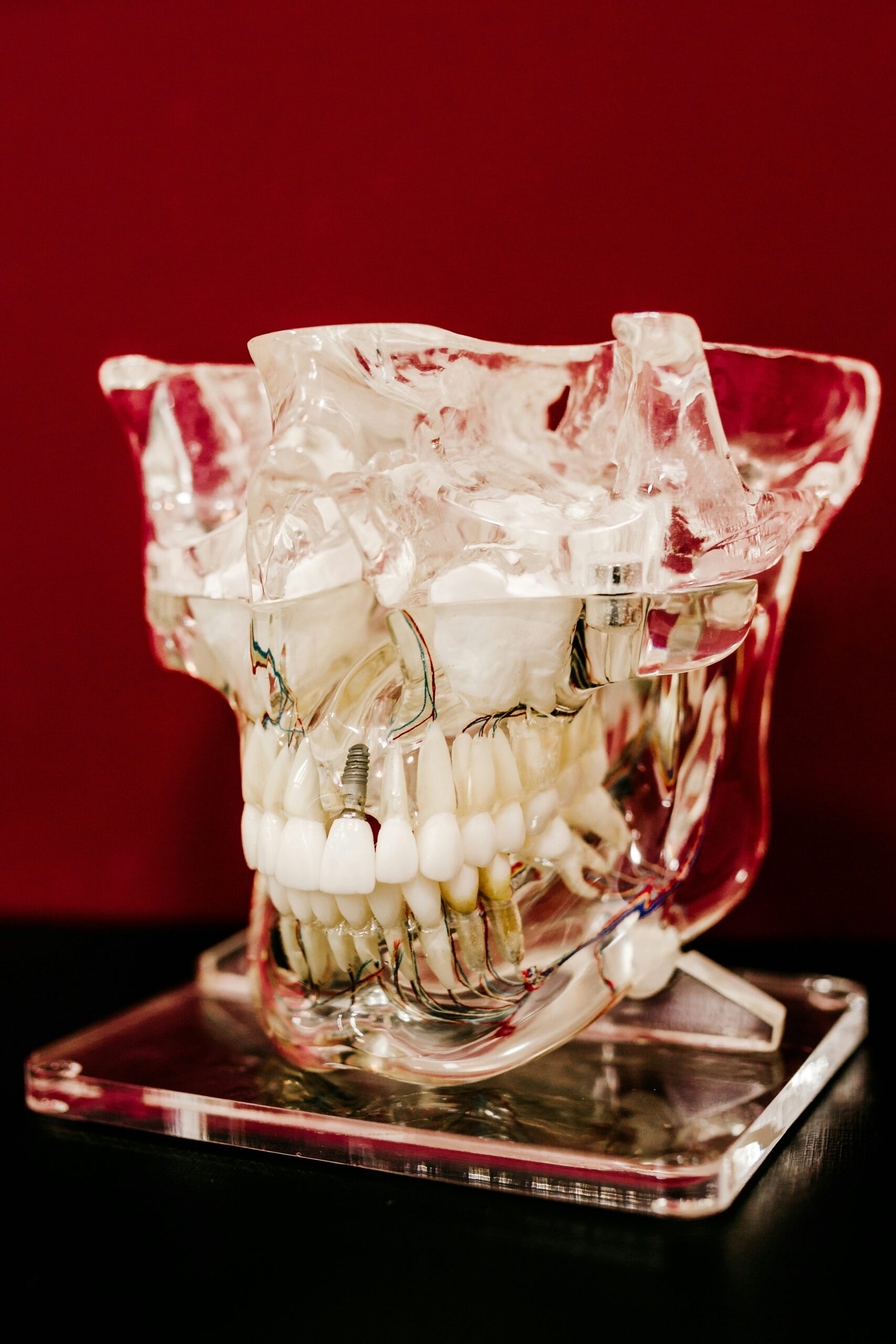 Dental Implants near Corning ca