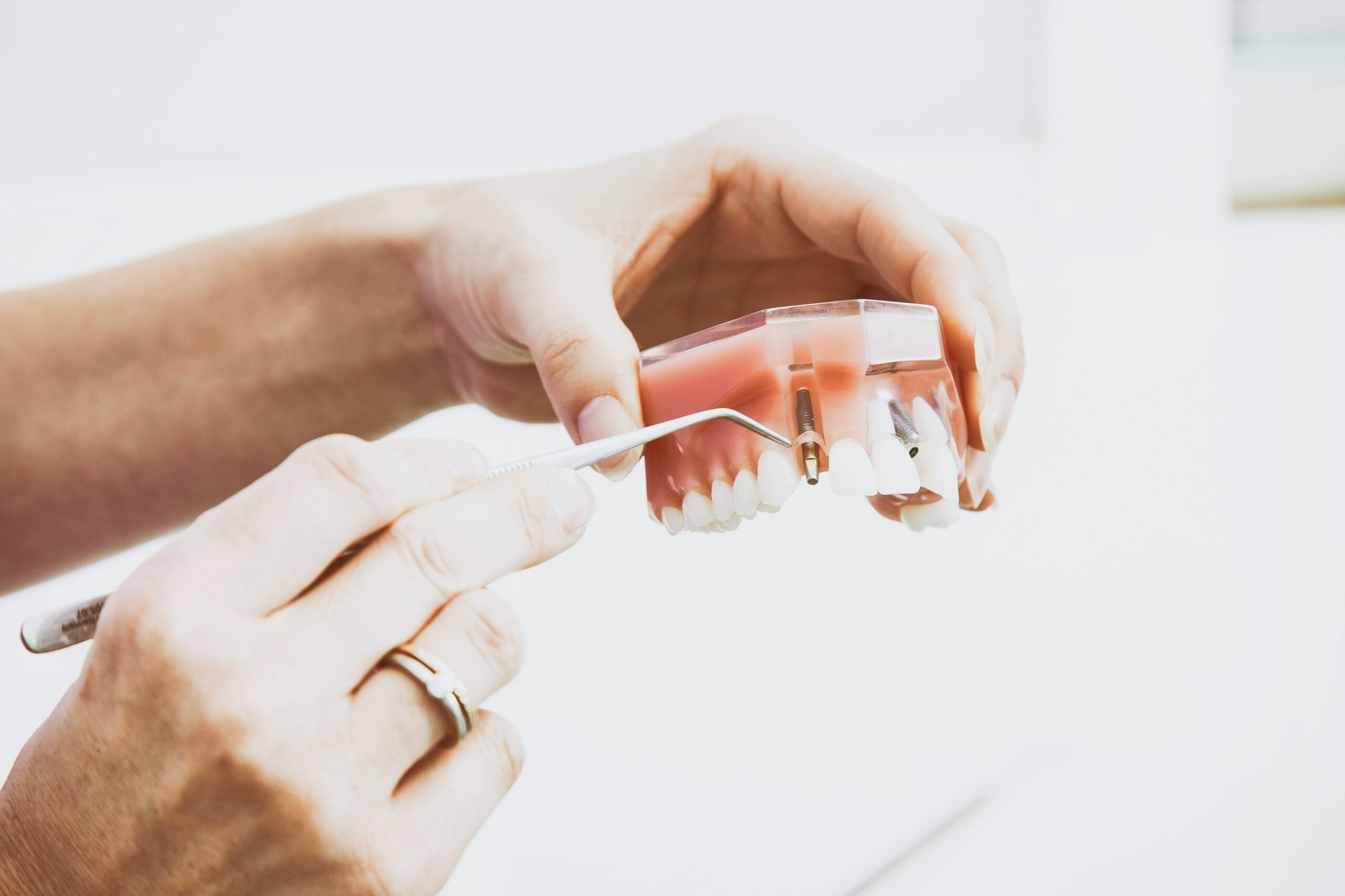 dental implant recovery
