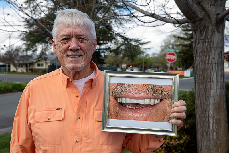 dental implant before and after